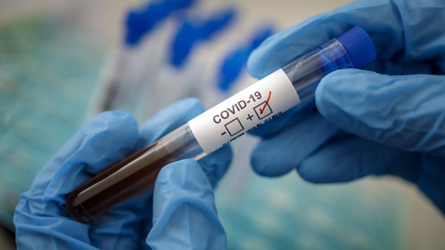 Подтвердился анализ на коронавирус у 8 ранее госпитализированных с признаками ОРВИ